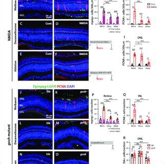 M1-like pro-inflammatory microglia are transiently identified in the ... 
