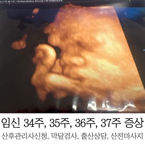 임신 34주 35주 36주 37주 증상 네이버 블로그