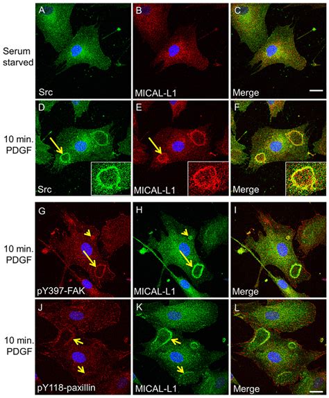 Mical L Colocalizes With Src And Focal Adhesion Proteins Along Cdrs In