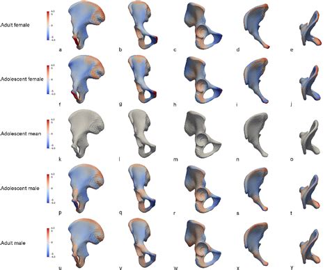 Figure 1 From New Insights On Hip Bone Sexual Dimorphism In Adolescents