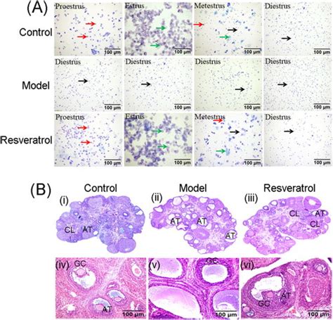 Full Article Resveratrol Improves Follicular Development Of PCOS Rats