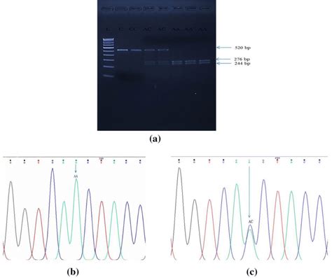 A Representative Gel Showing PCR Product Of Size 520 Bp And Restriction