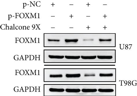 Foxm1 Overexpression Removed The Chalcone 9x Effects On Cell