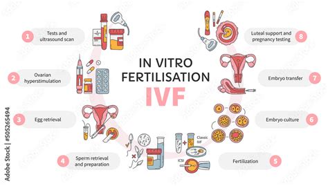 Vektorov Grafika In Vitro Fertilization Ivf Vector Circle Infographic