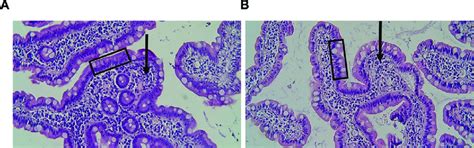 Tissue Morphology In Duodenum Intestinal Mucosa Biopsies A B