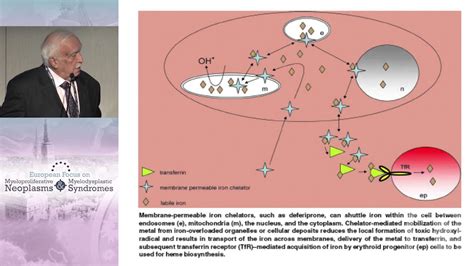 When And How To Use Iron Chelation Therapy In Mds Youtube