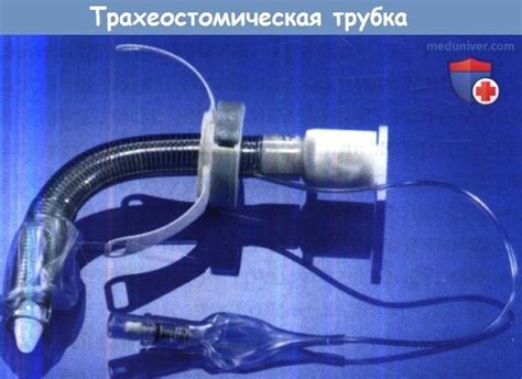 Показания и техника трахеотомии