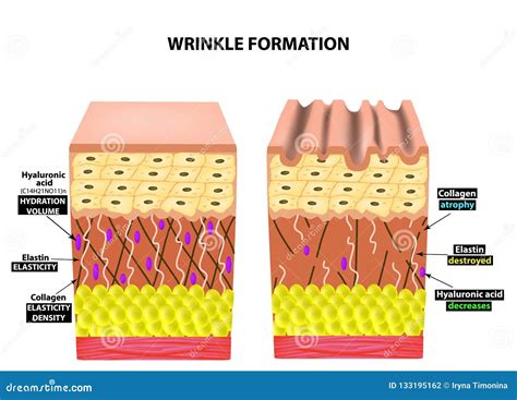 L Aspetto Delle Grinze Struttura Anatomica Della Pelle Elastina Acido