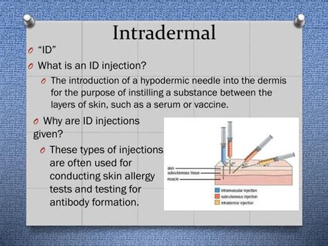 PPT - Injections “101” The Basics on Injection Types, Sites, and ...