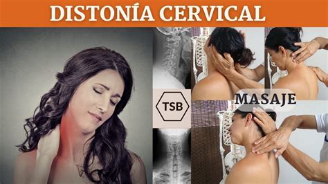 Diston A Cervical Tort Colis Youtube