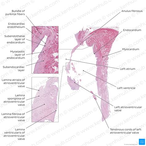 Atrioventricular Valve Histology