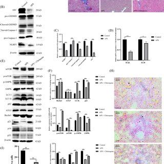 Schematic Showing How Astragalus Polysaccharide Alleviates Hepatocyte