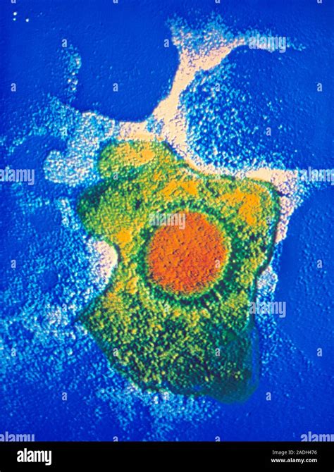 False Colour Transmission Electron Micrograph TEM Of A Single Virion