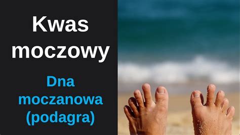 Kwas Moczowy Dna Moczanowa Podagra YouTube