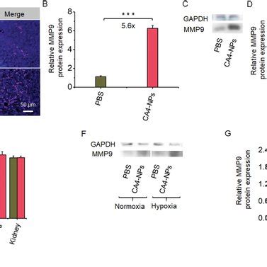 Preparation And Characterization Of Mmp Doxnps A Synthesis Of