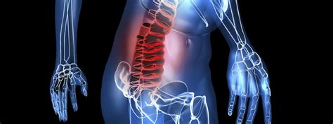 Neuromuscular Disease – MAMEM