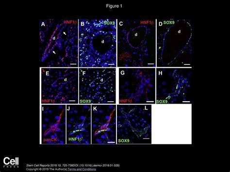 Heterogeneity of SOX9 and HNF1β in Pancreatic Ducts Is Dynamic - ppt ...