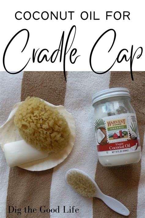 Coconut Oil For Cradle Cap Dig The Good Life