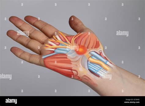 Carpal Tunnel Syndrome Cts Is A Compression Of The Median Nerve