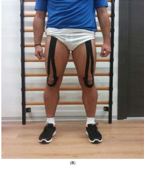 Figure 1 From Acute Effects Of Kinesio Taping On Functional Performance