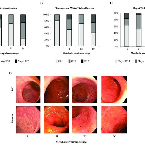 Clinical And Laboratory Findings In Ulcerative Colitis Uc Patients Download Scientific Diagram