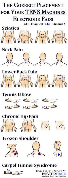 10 Best Tens Unit Placement Charts Images Massage Tens Electrode Placement Tens Unit Placement