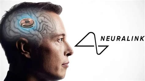 Neuralink Elon Musk Confirma El Primer Implante Exitoso En Un Humano