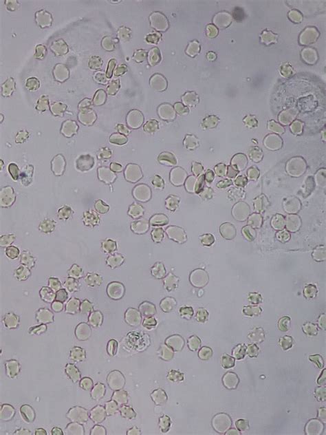 272 questions with answers in URINE | Science topic