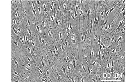 Primary Rat Schwann Cells A Representative Image Of Rat Schwann Cells