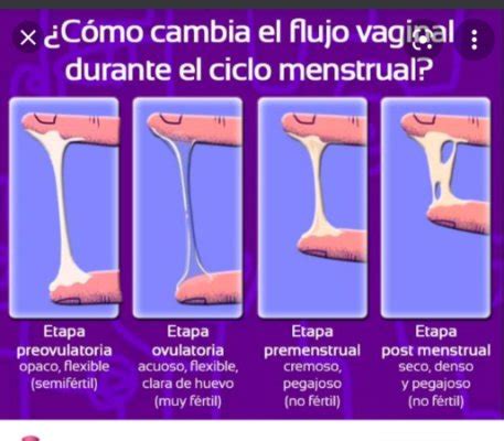 Tipos De Flujos Babycenter