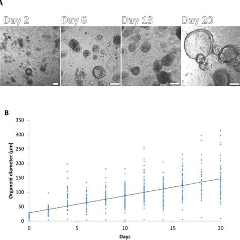 Morphology Of Nasal Organoids Generated From Primary Human Nasal