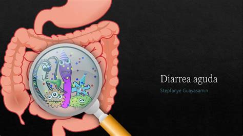 Diarrea Aguda Stepfanye Guayasamin Udocz