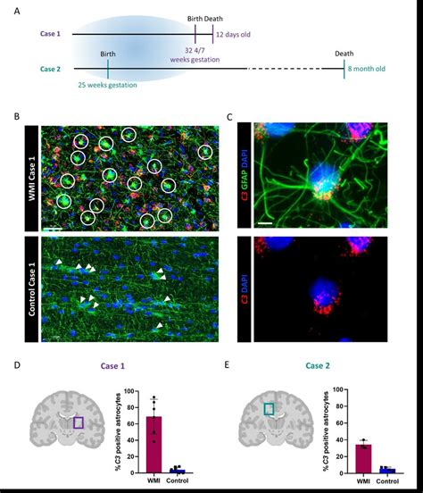 Formation Of C3 Expressing Astrocytes In The Human Brain Of Perinatal