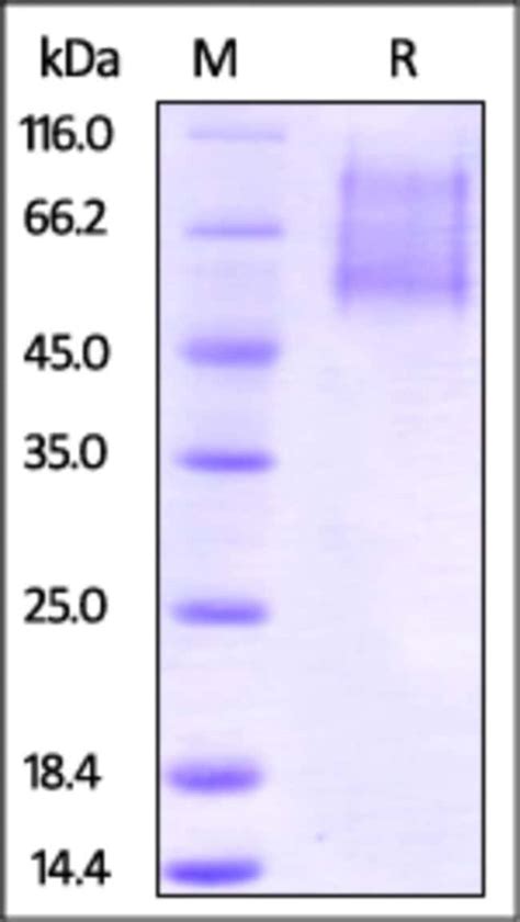 Acrobiosystems Acrobiosystems Biotinylated Human Cx Cl Protein His