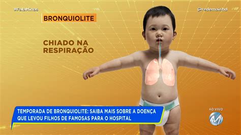 Temporada De Bronquiolite Saiba Mais Sobre A Doen A Que Levou Filho De