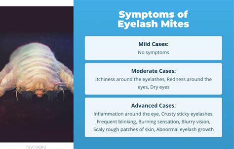 Eyelash Mites Symptoms And How To Get Rid Of Them Fast Nvision