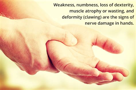 Nerve Damage In Hands Causes Symptoms And Treatment