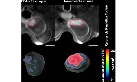 A Single Dose Of Urea Powered Nanorobots Reduces Bladder Tumors By 90