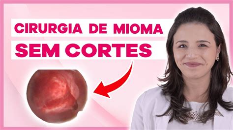 Mioma Submucoso Tudo o que você precisa saber Vídeo cirurgia