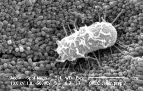 Introductory Chapter The Versatile Escherichia Coli Intechopen