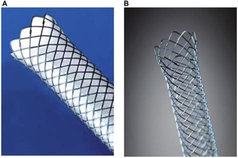 Wallflex Biliary Metallic Stents From Boston Scientific A Fully