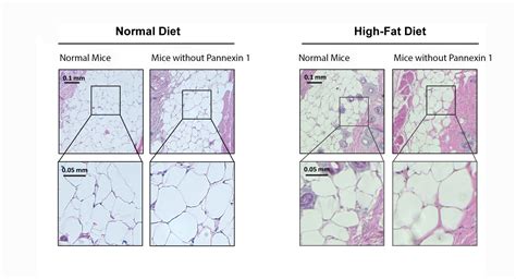 Researchers Uncover Gene That Regulates Fat Accumulation And Obesity