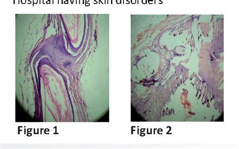 Figure From Evaluation Of Histopathological Findings Of Skin Biopsies