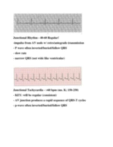 SOLUTION Relias Dysrhythmia Basic Test Answers Solution Guide Studypool