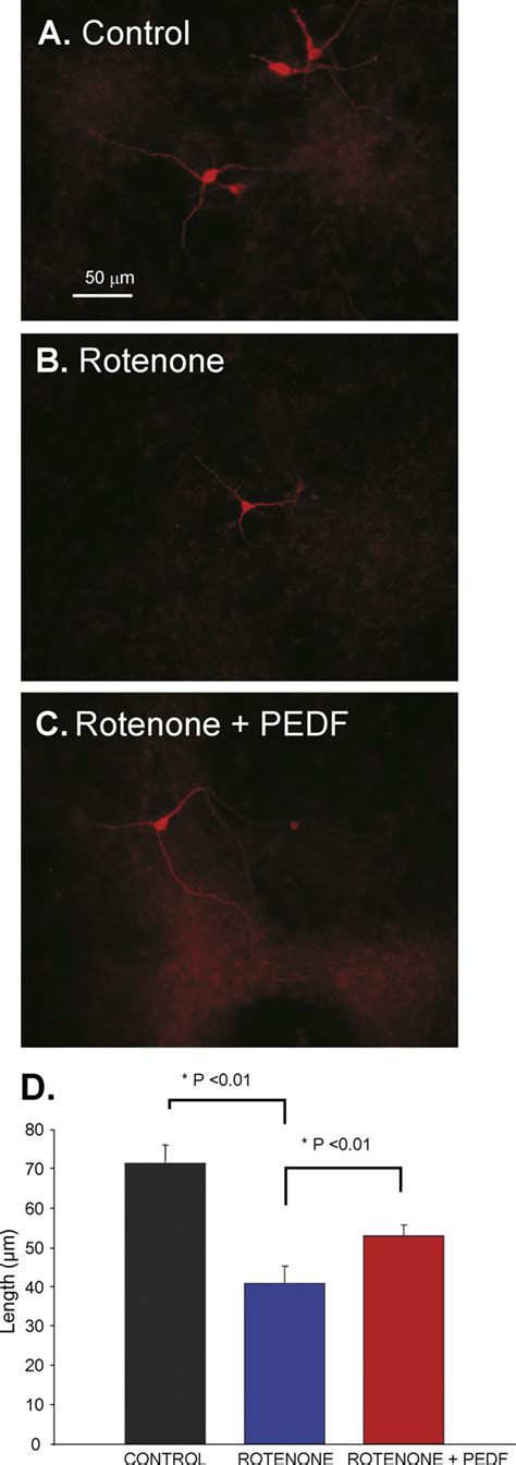 PEDF Partially Reverses Effect Of Rotenone On Neurite Length Neurite