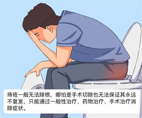 痔疮怎么治疗能除根 有来医生