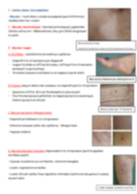 Solution Examen Clinique En Dermatologie Studypool