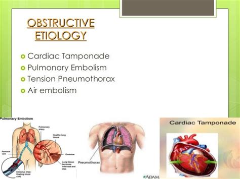 Shock - Pathophysiology / Types & Management