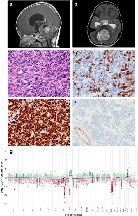 Radiologic Histological And Molecular Findings In The Group