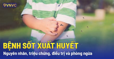 Rất Hay Sốt Xuất Huyết Nguyên Nhân Triệu Chứng điều Trị Và Phòng Ngừa